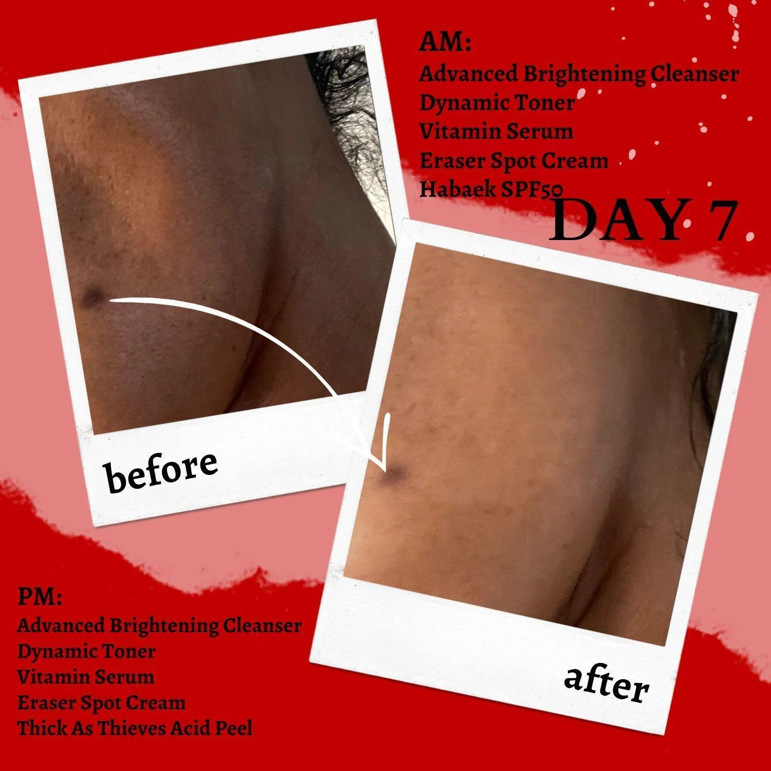 The Eraser Spot Cream | Dark Spot Remover - Image 4