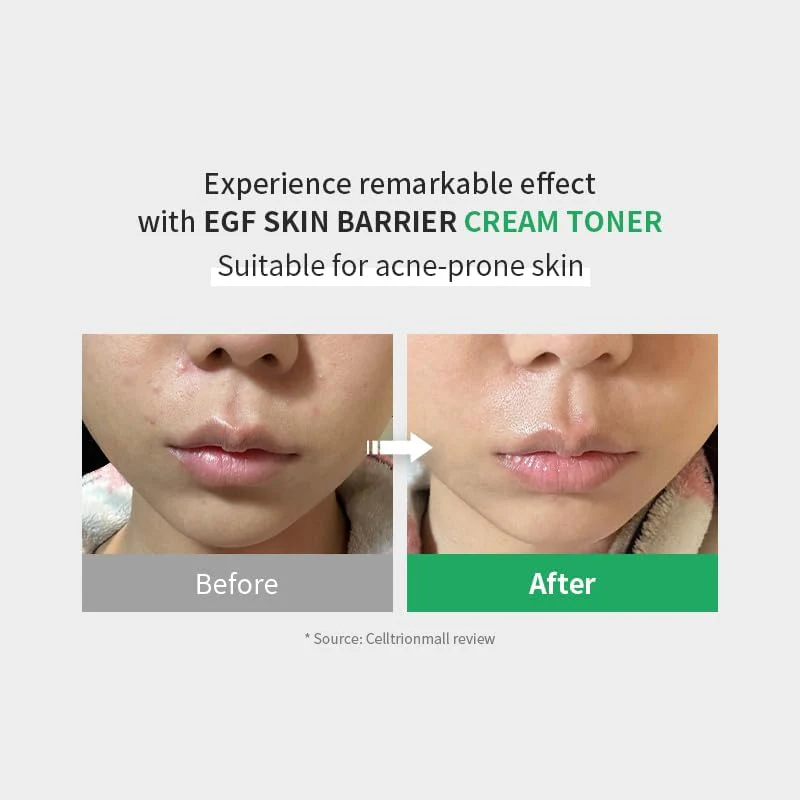 Z+PIDERM ECF Skin Barrier Cream Toner - Image 2